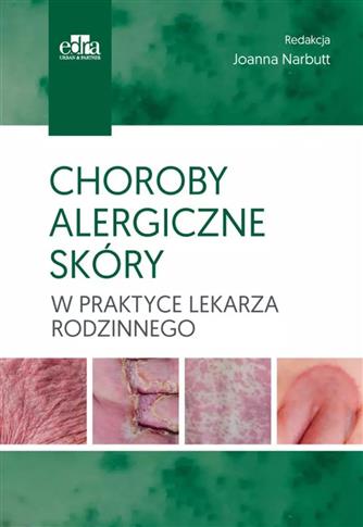 Choroby alergiczne skóry w praktyce lekarza rodzin