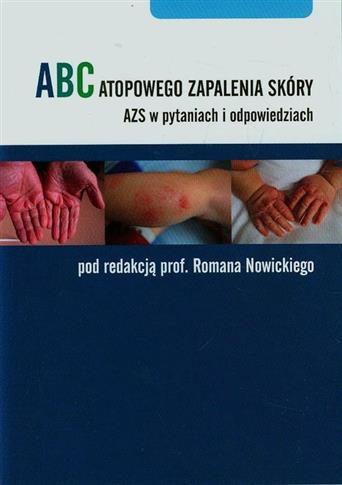 ABC atopowego zapalenia skóry