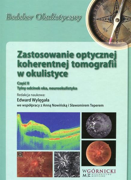 Zastosowanie optycznej koherentnej tomografii w ok