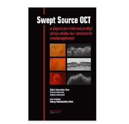 SWEPT SOURCE OCT